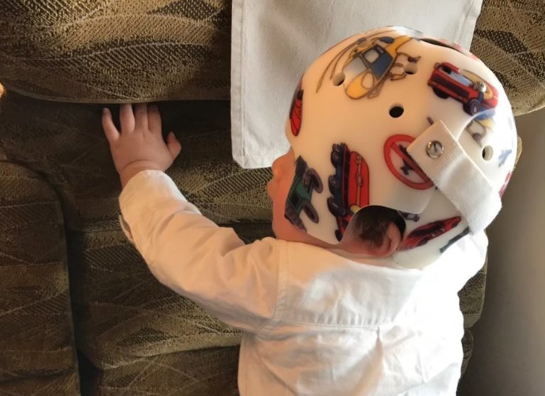 赤ちゃんの頭の形を矯正するヘルメット【治療体験談】 のんびりファクトリー